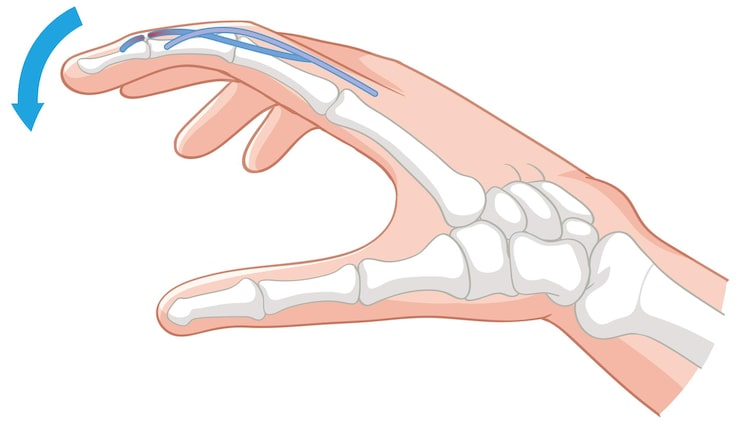 Ilustración de la anatomía y el movimiento de la mano durante la recuperación funcional