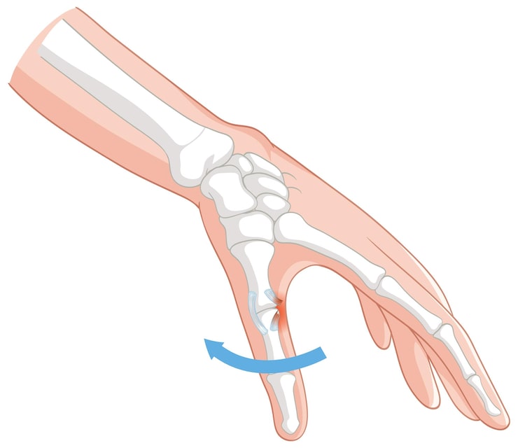 Ilustración médica de la anatomía de la mano y la muñeca en la Unidad de Mano y Muñeca de Novotrauma