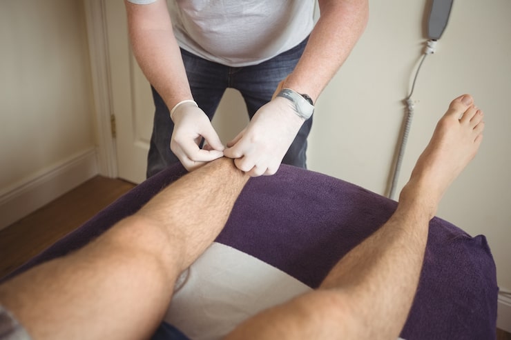 Fisioterapeuta realizando una técnica de punción seca en la pierna de un paciente como parte del tratamiento de rodilla